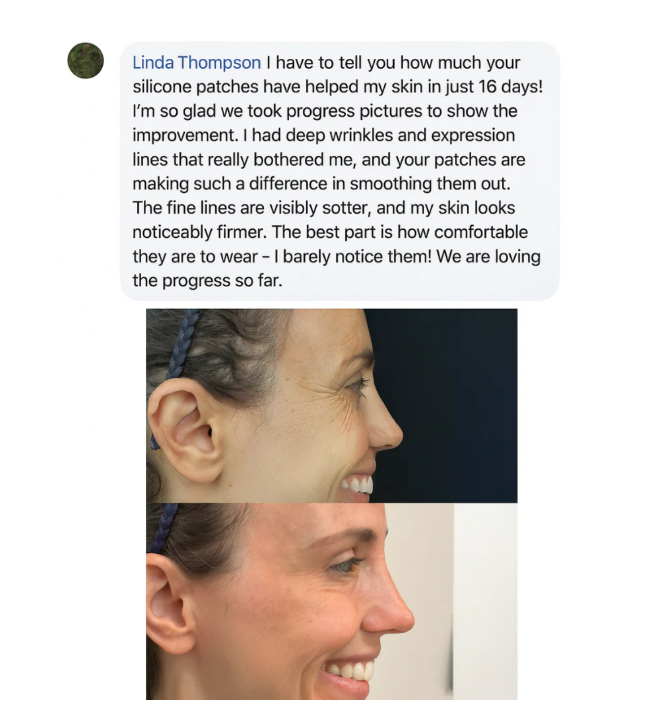 Silicone Beauty Patches